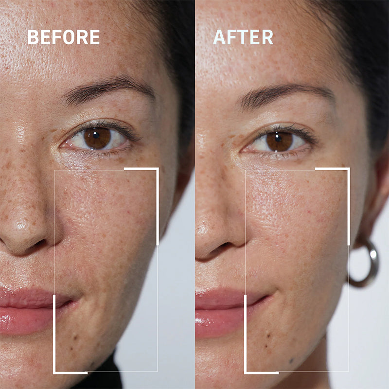 Newyuo™ Needle-less Growth Factor Face Serum, to Visibly Reduce Wrinkles, Improve Firmness & Skin Texture