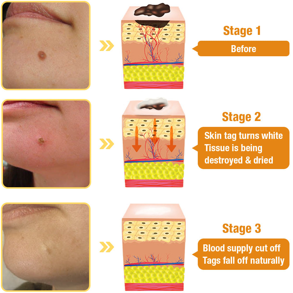 đLOVILDS⢠TagRecede Bee Venom Treatment Spray