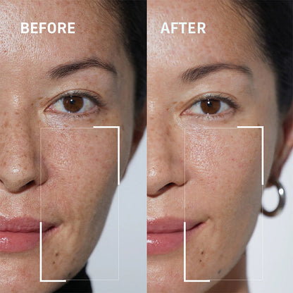 Newyuo™ Needle-less Growth Factor Face Serum, to Visibly Reduce Wrinkles, Improve Firmness & Skin Texture
