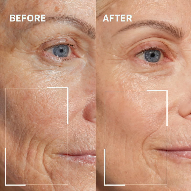 Newyuo™ Needle-less Growth Factor Face Serum, to Visibly Reduce Wrinkles, Improve Firmness & Skin Texture