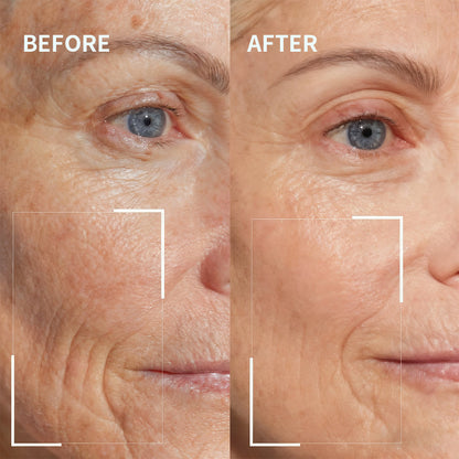 Newyuo™ Needle-less Growth Factor Face Serum, to Visibly Reduce Wrinkles, Improve Firmness & Skin Texture